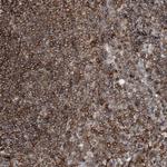 PRMT9 Polyclonal Antibody