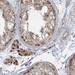 BEND4 Antibody in Immunohistochemistry (Paraffin) (IHC (P))