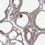 HELQ Polyclonal Antibody