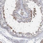 SPATA18 Antibody in Immunohistochemistry (IHC)