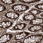 DALRD3 Antibody in Immunohistochemistry (Paraffin) (IHC (P))