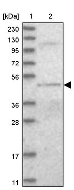 DALRD3 Antibody in Western Blot (WB)