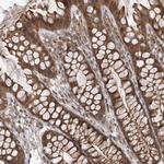 GFM2 Antibody in Immunohistochemistry (Paraffin) (IHC (P))