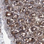 COPB2 Antibody in Immunohistochemistry (Paraffin) (IHC (P))