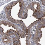COPB2 Antibody in Immunohistochemistry (Paraffin) (IHC (P))