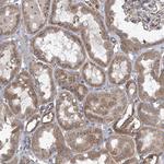 COPB2 Antibody in Immunohistochemistry (Paraffin) (IHC (P))
