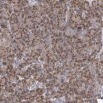 COPB2 Antibody in Immunohistochemistry (Paraffin) (IHC (P))
