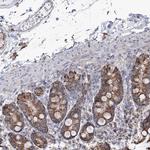 CWF19L1 Antibody in Immunohistochemistry (Paraffin) (IHC (P))