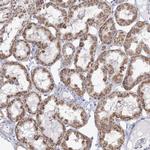 CWF19L1 Antibody in Immunohistochemistry (Paraffin) (IHC (P))