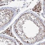 CWF19L1 Antibody in Immunohistochemistry (IHC)