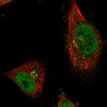 CWF19L1 Polyclonal Antibody