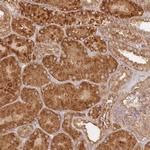 KIAA0232 Antibody in Immunohistochemistry (Paraffin) (IHC (P))
