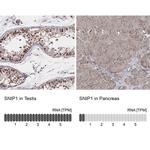 SNIP1 Antibody in Immunohistochemistry (IHC)