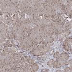 SNIP1 Antibody in Immunohistochemistry (IHC)