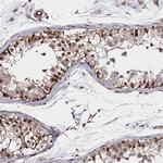 SNIP1 Antibody in Immunohistochemistry (IHC)