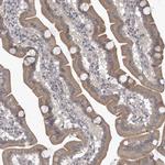 ZC3H12D Antibody in Immunohistochemistry (Paraffin) (IHC (P))