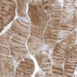 ZC3H12D Antibody in Immunohistochemistry (Paraffin) (IHC (P))