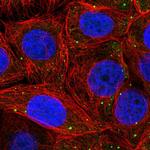 PSMD6 Polyclonal Antibody