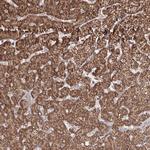 PSMD6 Antibody in Immunohistochemistry (Paraffin) (IHC (P))