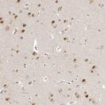 PSMD6 Antibody in Immunohistochemistry (Paraffin) (IHC (P))