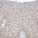 PSMD6 Antibody in Immunohistochemistry (Paraffin) (IHC (P))