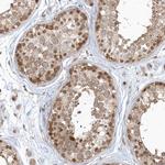 PSMD6 Antibody in Immunohistochemistry (Paraffin) (IHC (P))