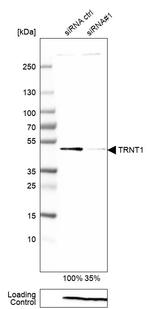TRNT1 Antibody in Western Blot (WB)