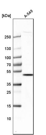 TRNT1 Antibody in Western Blot (WB)