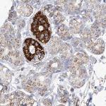 PCCB Polyclonal Antibody