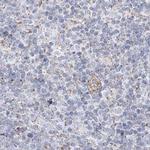PCCB Antibody in Immunohistochemistry (Paraffin) (IHC (P))
