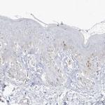 PCCB Antibody in Immunohistochemistry (IHC)