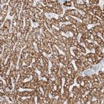 PCCB Antibody in Immunohistochemistry (IHC)