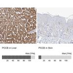 PCCB Antibody
