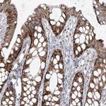 PCCB Antibody in Immunohistochemistry (IHC)