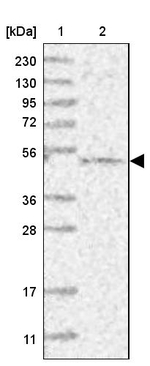 BITE Antibody in Western Blot (WB)