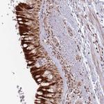 FAM44A Polyclonal Antibody