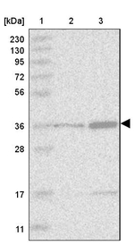 DNMT2 Antibody in Western Blot (WB)