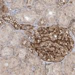 RAI14 Antibody in Immunohistochemistry (Paraffin) (IHC (P))