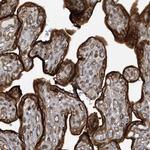 RAI14 Antibody in Immunohistochemistry (Paraffin) (IHC (P))