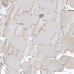 RAI14 Antibody in Immunohistochemistry (Paraffin) (IHC (P))