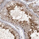 RAI14 Antibody in Immunohistochemistry (Paraffin) (IHC (P))