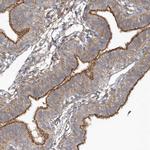 RAI14 Antibody in Immunohistochemistry (Paraffin) (IHC (P))