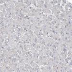 RAI14 Antibody in Immunohistochemistry (Paraffin) (IHC (P))