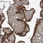 RAI14 Antibody in Immunohistochemistry (Paraffin) (IHC (P))