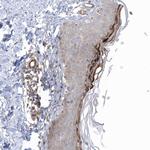 RAI14 Antibody in Immunohistochemistry (Paraffin) (IHC (P))