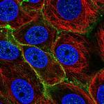 SLC5A6 Polyclonal Antibody