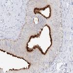 SLC5A6 Antibody in Immunohistochemistry (Paraffin) (IHC (P))