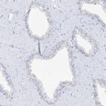 SLC5A6 Antibody in Immunohistochemistry (Paraffin) (IHC (P))