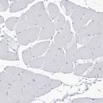 SLC5A6 Antibody in Immunohistochemistry (Paraffin) (IHC (P))