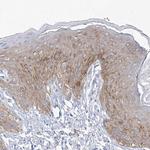 SLC5A6 Antibody in Immunohistochemistry (Paraffin) (IHC (P))